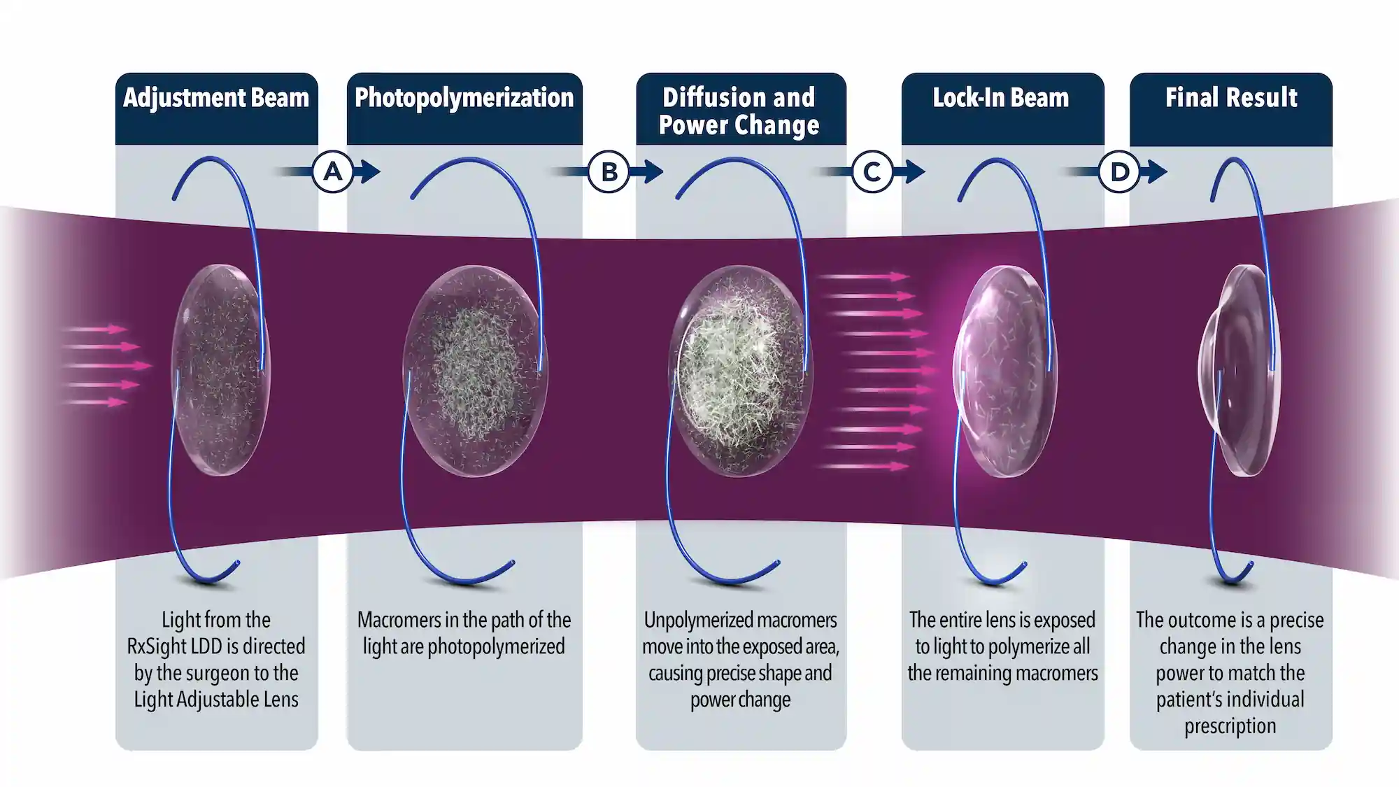 Graphic showing how LAL works